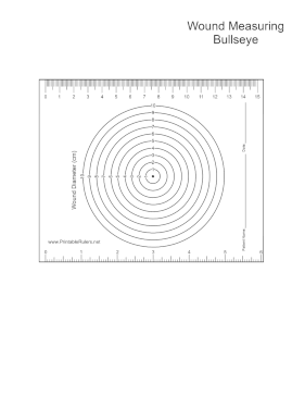 Wound Bullseye Printable Ruler