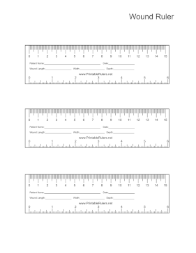 Wound Ruler Printable Ruler